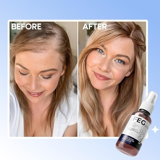 FEG Plus Hair Growth Spray | Advanced Scalp & Hair Care Formula