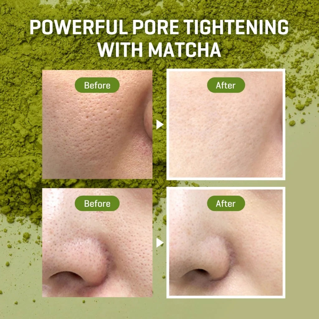 Matcha Pore Starter Kit